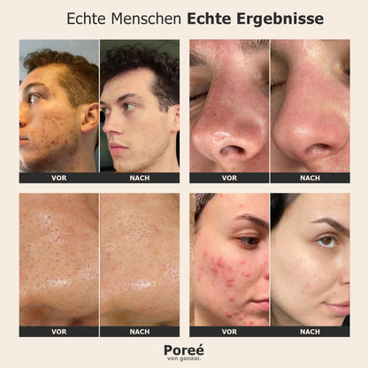 Poreé – Luxuriöser Porensauger